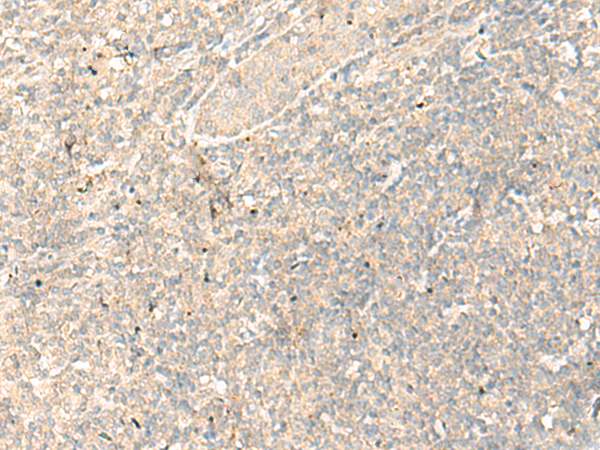 Rabbit Polyclonal Antibody to RGR