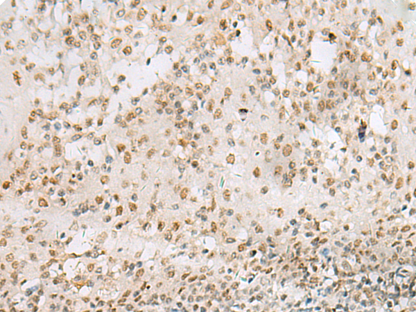 Rabbit Polyclonal Antibody to HNRNPA1L2