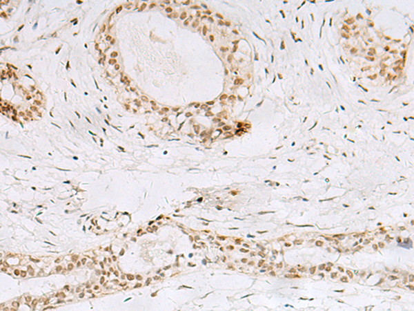 Rabbit Polyclonal Antibody to HNRNPA1L2