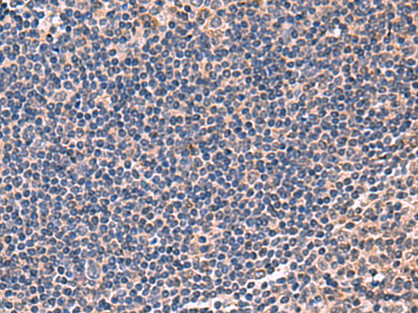 Rabbit Polyclonal Antibody to IPPK
