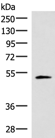 IRX1