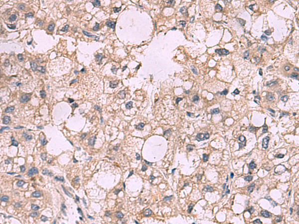 KCNIP1