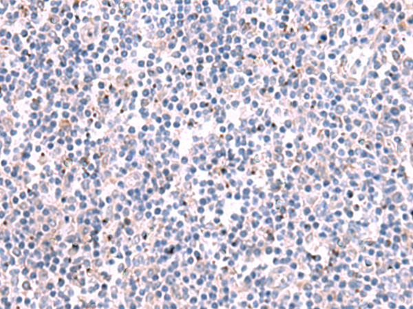 KCNK10