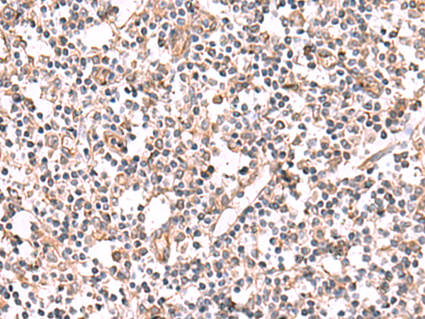 KCNK12