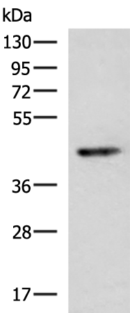 KCNK2