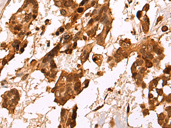 HDAC7
