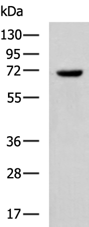 SLC28A1