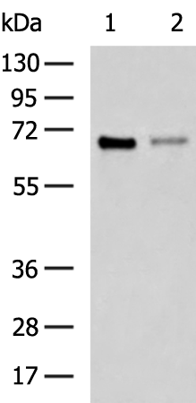 ESR1