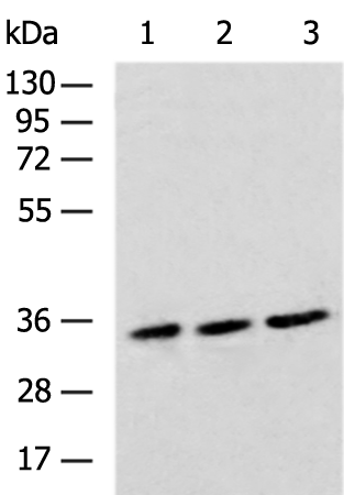 OPRM1