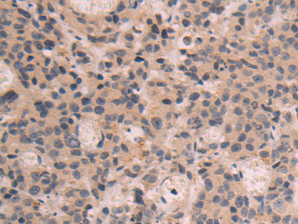 SLC25A39