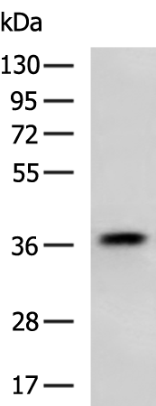 ANXA8