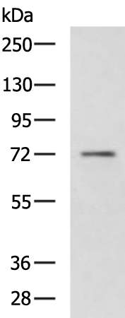 AKAP8L