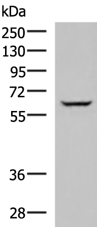 ACVR1B
