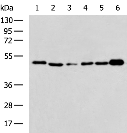 CD274