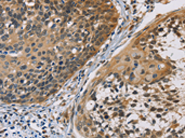 Rabbit Polyclonal Antibody to CBR1