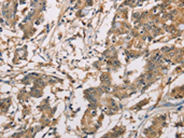 Rabbit Polyclonal Antibody to CBR1