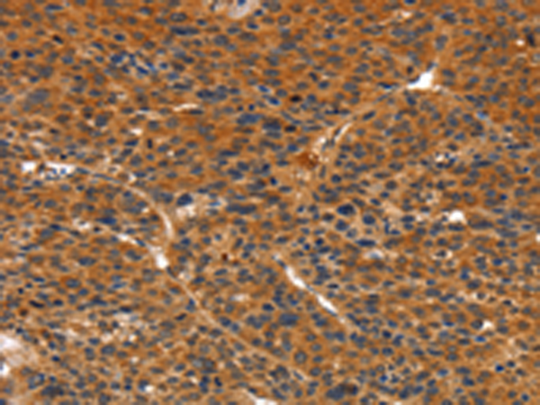 Rabbit Polyclonal Antibody to IKZF3