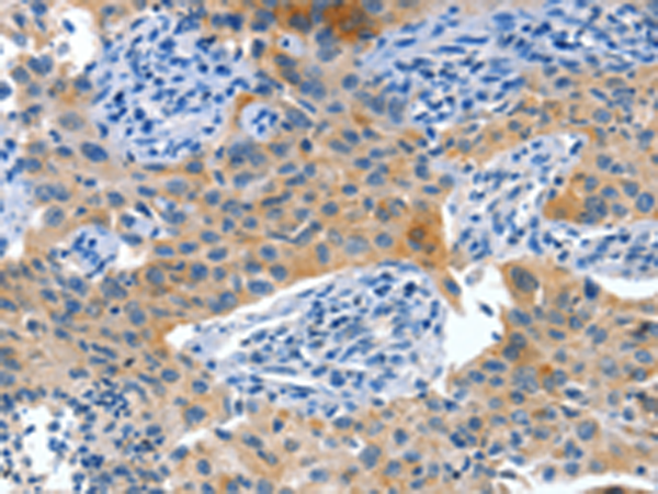 Rabbit Polyclonal Antibody to ALPP