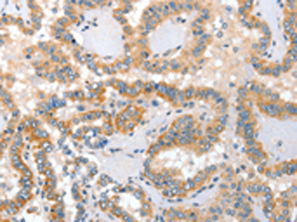Rabbit Polyclonal Antibody to ALPP