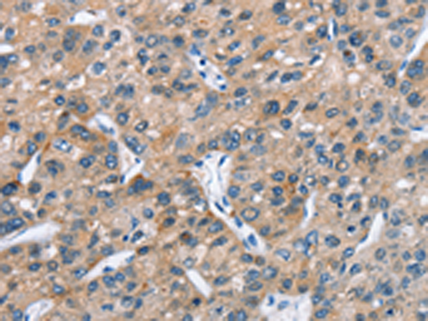 Rabbit Polyclonal Antibody to ARMCX2