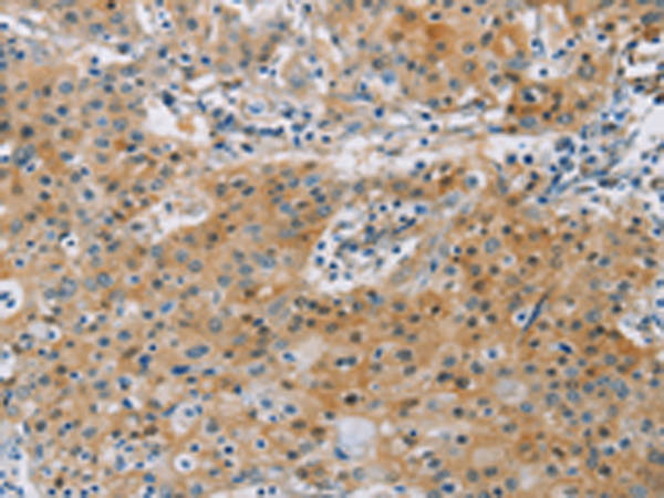 KCNMA1