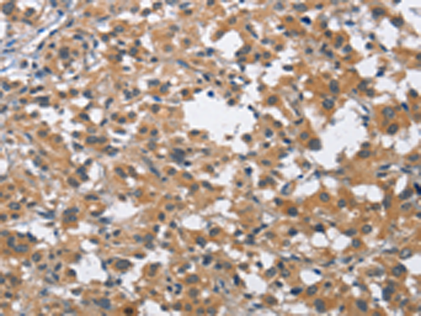Rabbit Polyclonal Antibody to BUB1