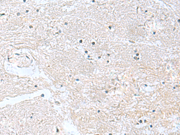 CACNB1