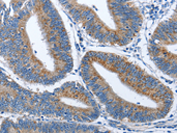 Rabbit Polyclonal Antibody to CADM3