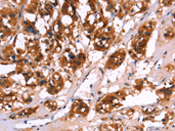 Rabbit Polyclonal Antibody to CALB1