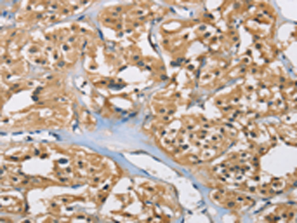 Rabbit Polyclonal Antibody to PPP3CA
