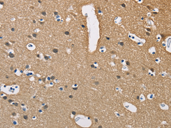Rabbit Polyclonal Antibody to PPP3CA