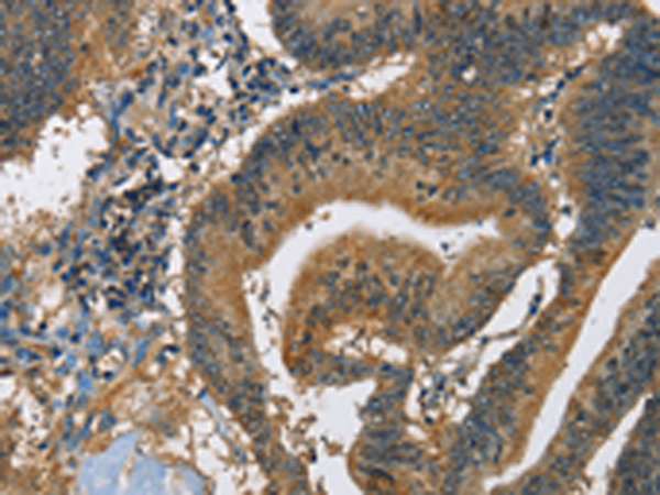 Rabbit Polyclonal Antibody to CAST