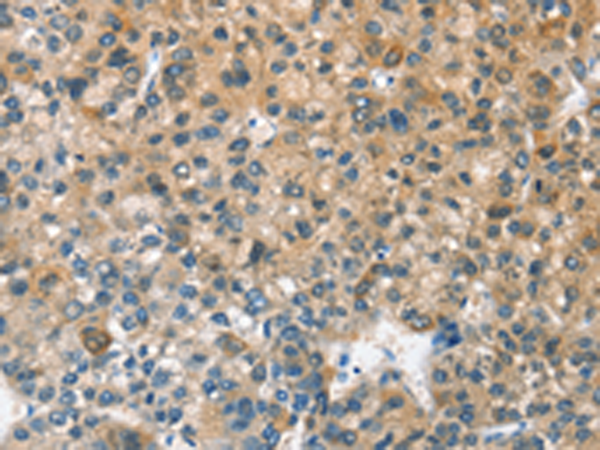 Rabbit Polyclonal Antibody to CASQ2