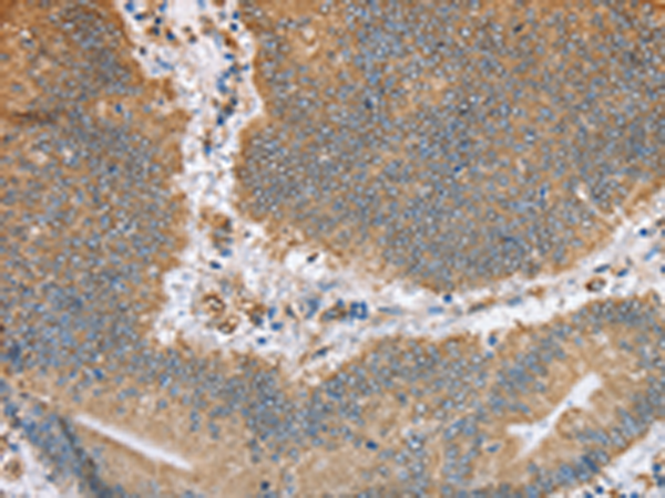 Rabbit Polyclonal Antibody to CANX