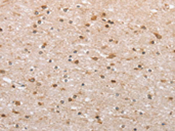 Rabbit Polyclonal Antibody to CANX