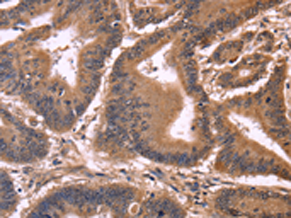 CCDC106