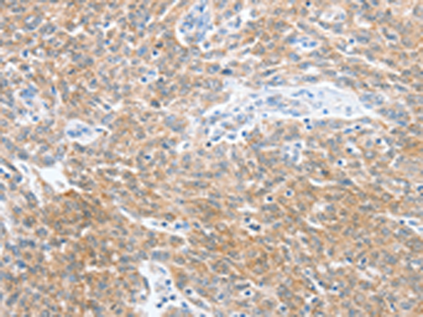 Rabbit Polyclonal Antibody to CKAP2