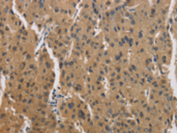 Rabbit Polyclonal Antibody to CKMT2