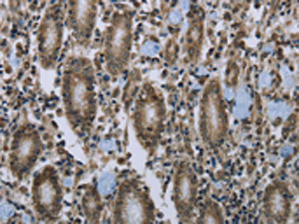 Rabbit Polyclonal Antibody to CLPS