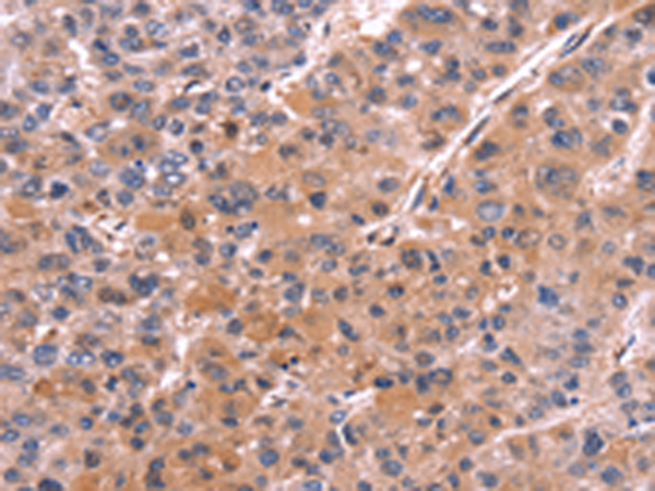 COL20A1