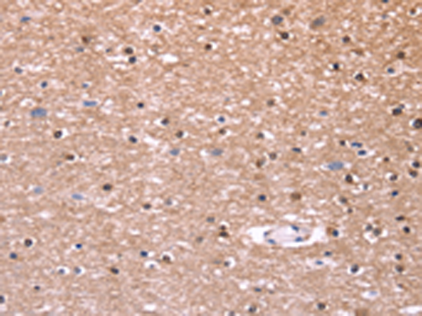 Rabbit Polyclonal Antibody to COL20A1