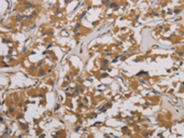 Rabbit Polyclonal Antibody to CORO1C