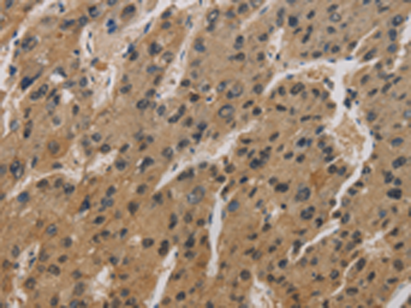 Rabbit Polyclonal Antibody to CORO1C