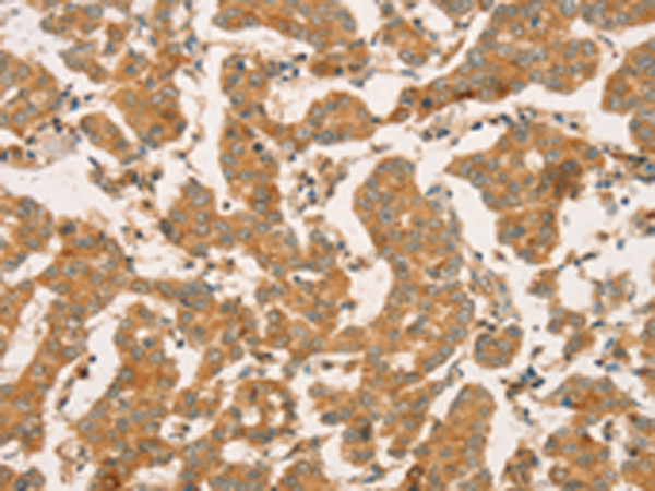 Rabbit Polyclonal Antibody to CPB1