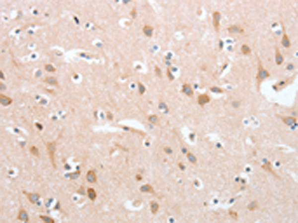Rabbit Polyclonal Antibody to PLA2G4A