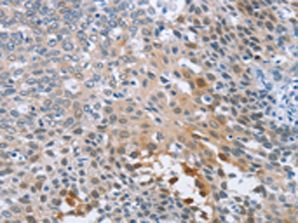 Rabbit Polyclonal Antibody to CRABP2