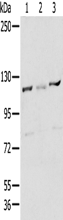 RBBP8
