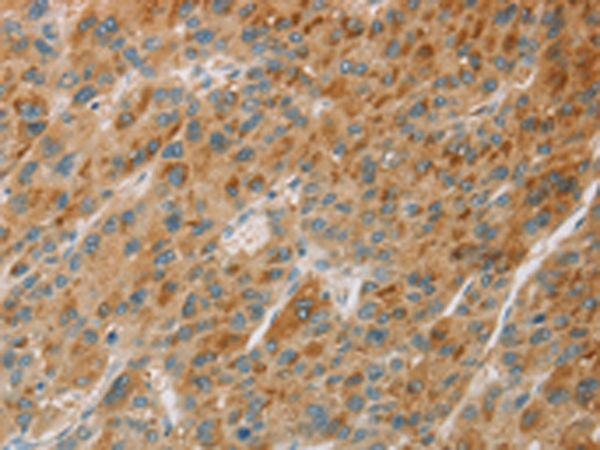 CYP11B1