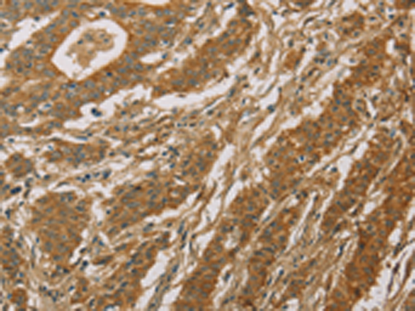 CYP39A1