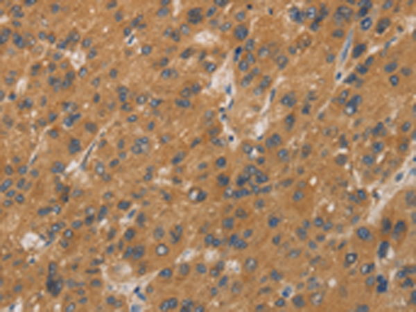 CYP17A1